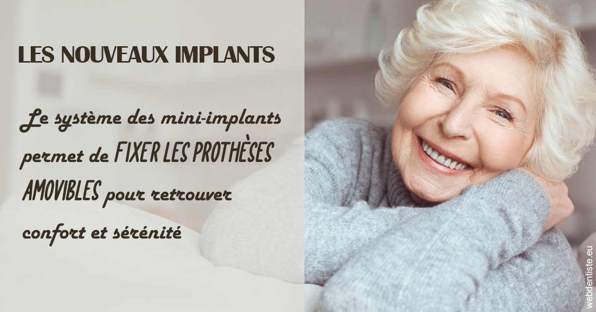 https://selarl-marche-soligni.chirurgiens-dentistes.fr/Les nouveaux implants 1