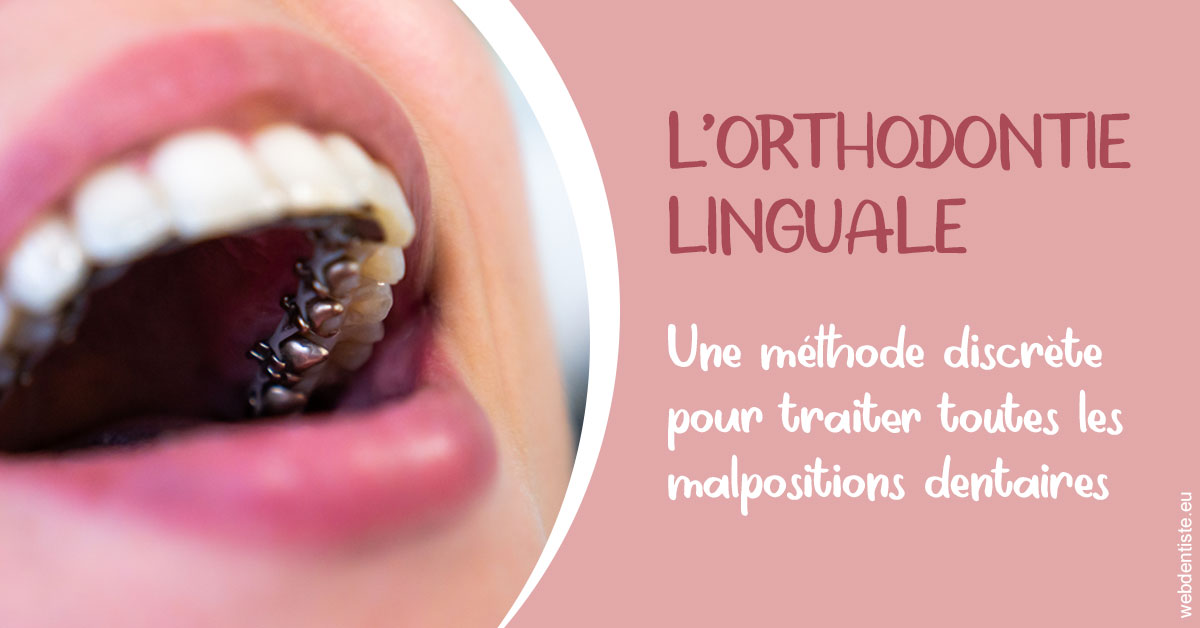 https://selarl-marche-soligni.chirurgiens-dentistes.fr/L'orthodontie linguale 2