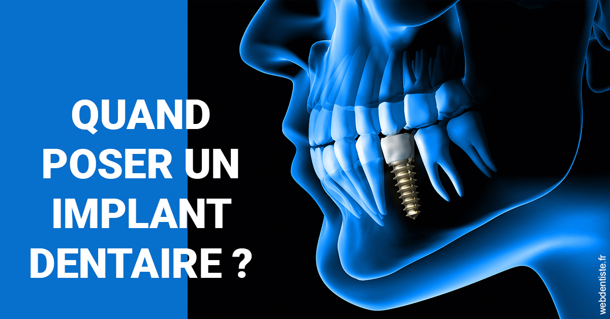 https://selarl-marche-soligni.chirurgiens-dentistes.fr/Les implants 1
