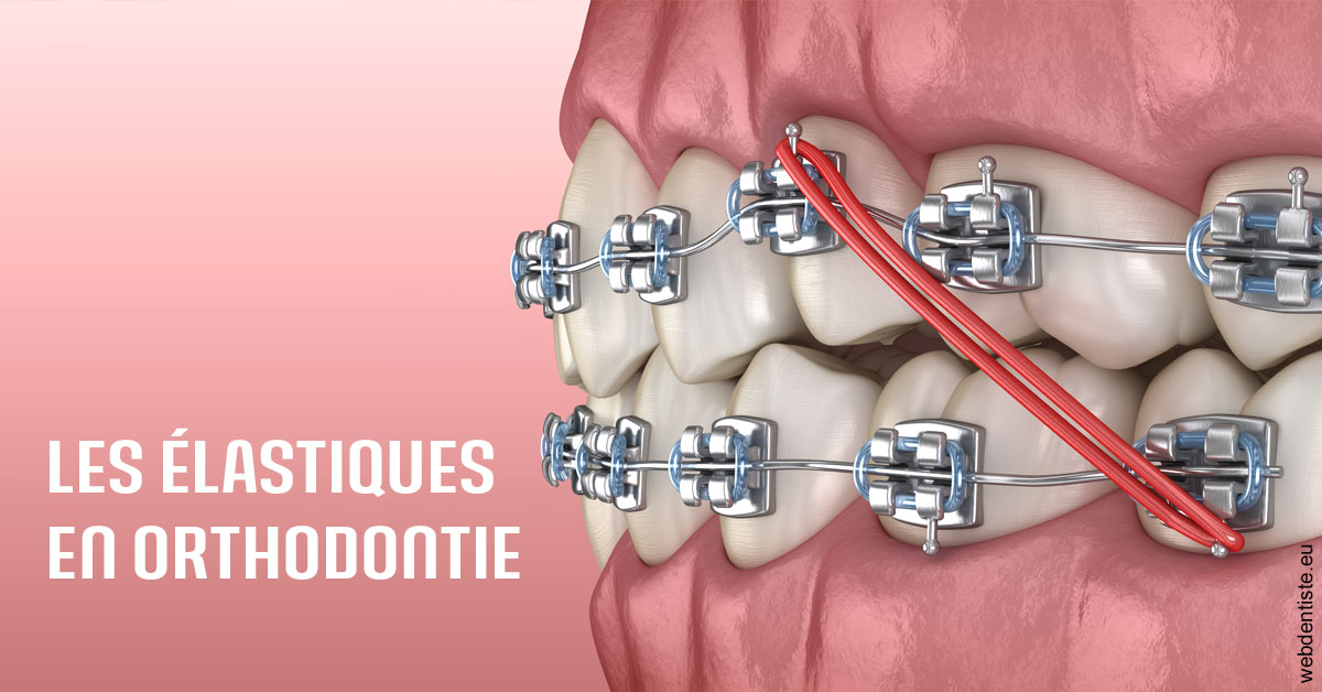 https://selarl-marche-soligni.chirurgiens-dentistes.fr/Elastiques orthodontie 2