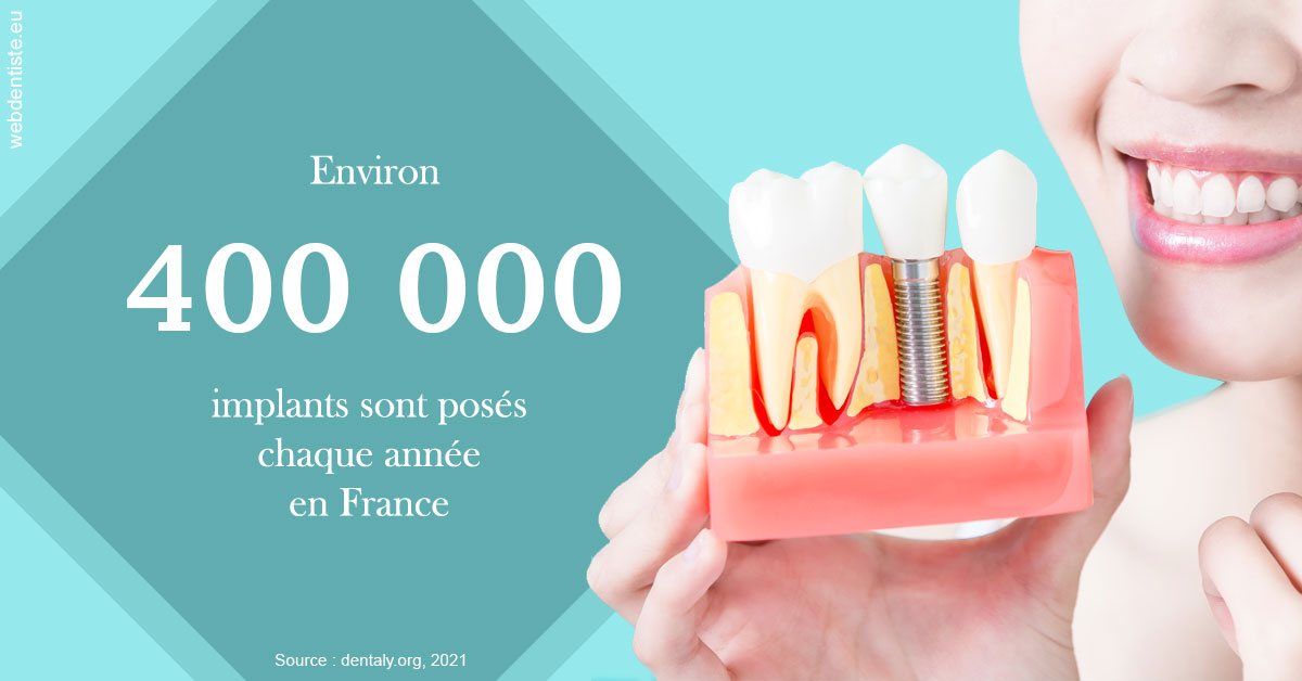 https://selarl-marche-soligni.chirurgiens-dentistes.fr/Pose d'implants en France 2